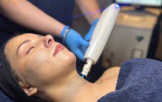 Client receiving Harmony XL PRO ClearLift treatment at SKIN lounge Aesthetics Richmond, using advanced fractional laser technology to lift, tone, and revitalise the skin without downtime.