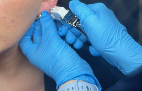 Client receiving a Sterex 9ct gold ear piercing at SKIN lounge Aesthetics Richmond, using a sterile, professional technique for safe results.