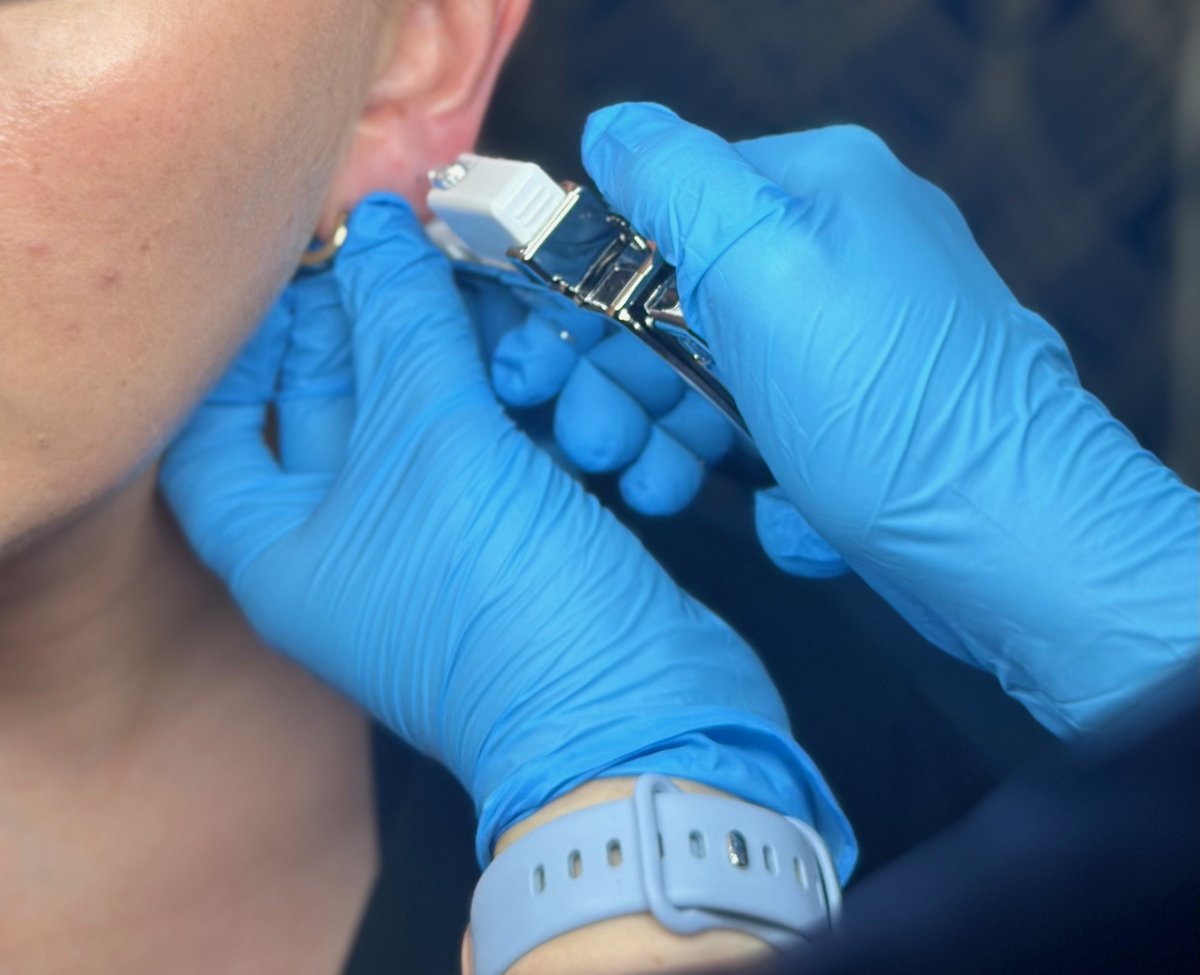 Client receiving a Sterex 9ct gold ear piercing at SKIN lounge Aesthetics Richmond, using a sterile, professional technique for safe results.