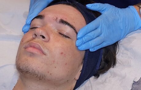 Client enjoying a HydraClean deep-cleansing facial at SKIN lounge Aesthetics Richmond Hill, an expert treatment combining professional techniques and targeted skincare to deeply cleanse, purify, and reduce acne, congestion, and scarring.