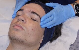 Client enjoying a HydraClean deep-cleansing facial at SKIN lounge Aesthetics Richmond Hill, an expert treatment combining professional techniques and targeted skincare to deeply cleanse, purify, and reduce acne, congestion, and scarring.