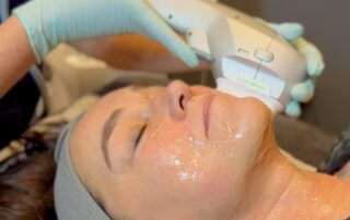 Client enjoying a HydraLift facial at SKIN lounge Aesthetics Richmond Hill, combining advanced Hydra technology with HIFU Ultraformer III to deeply cleanse, hydrate, lift, and firm the skin for remarkable anti-ageing and rejuvenating results. Lifting and firming in real time