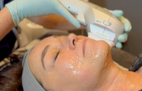 Client enjoying a HydraLift facial at SKIN lounge Aesthetics Richmond Hill, combining advanced Hydra technology with HIFU Ultraformer III to deeply cleanse, hydrate, lift, and firm the skin for remarkable anti-ageing and rejuvenating results. Lifting and firming in real time