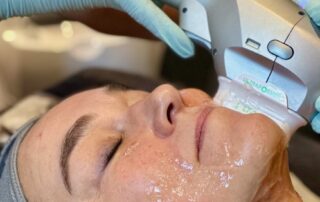 Client enjoying a HydraLift facial at SKIN lounge Aesthetics Richmond Hill, combining advanced Hydra technology with HIFU Ultraformer III to deeply cleanse, hydrate, lift, and firm the skin for remarkable anti-ageing and rejuvenating results.