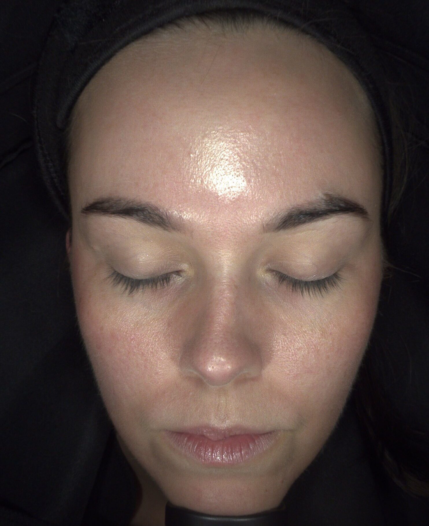 Client enjoying a HydraRefresh facial at SKIN lounge Aesthetics Richmond Hill, a cutting-edge treatment combining deep cleansing, exfoliation, and hydration technology to rejuvenate the skin, boost collagen, and enhance natural radiance.