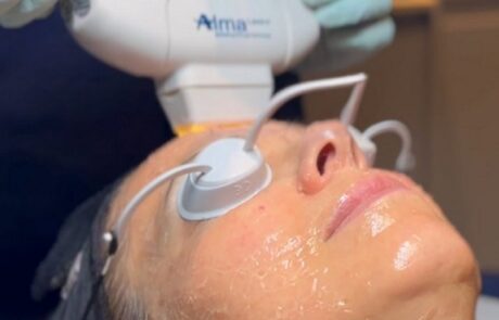 Client receiving Harmony XL PRO IPL Skin Rejuvenation at SKIN lounge Aesthetics Richmond, using advanced light technology to improve skin texture, reduce pigmentation, and enhance overall radiance.