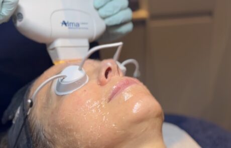 Client receiving Harmony XL PRO IPL Skin Rejuvenation at SKIN lounge Aesthetics Richmond, using advanced light technology to improve skin texture, reduce pigmentation, and enhance overall radiance.