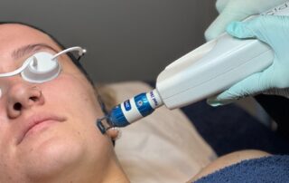 Client receiving Harmony XL PRO iPixel laser resurfacing treatment at SKIN lounge Aesthetics Richmond, targeting fine lines, sun damage, and uneven skin texture for a smoother, radiant complexion.