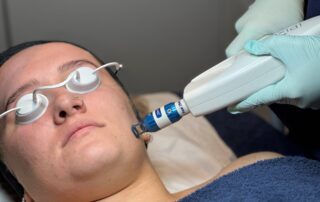 Client receiving Harmony XL PRO iPixel laser resurfacing treatment at SKIN lounge Aesthetics Richmond, targeting fine lines, sun damage, and uneven skin texture for a smoother, radiant complexion.