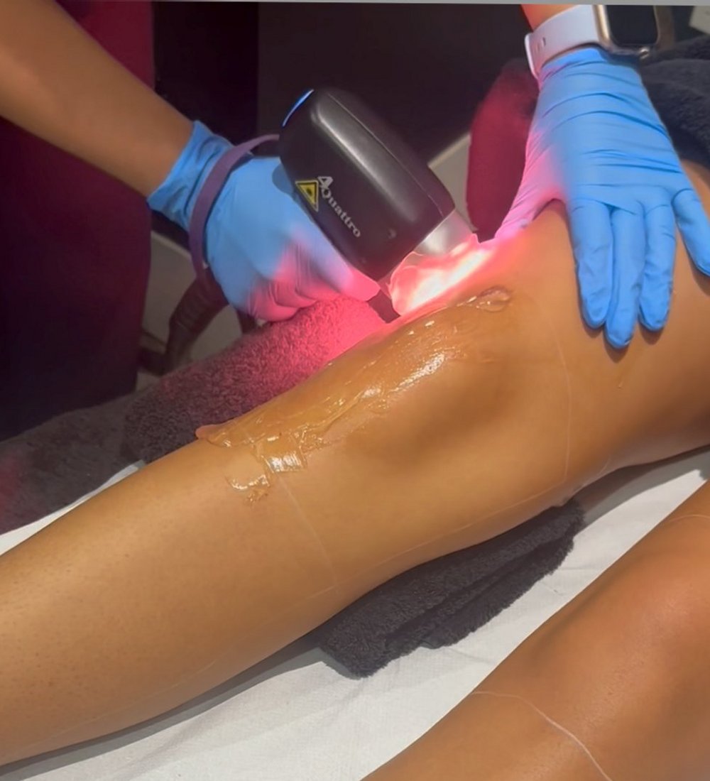 Laser Hair Removal 1000×1100