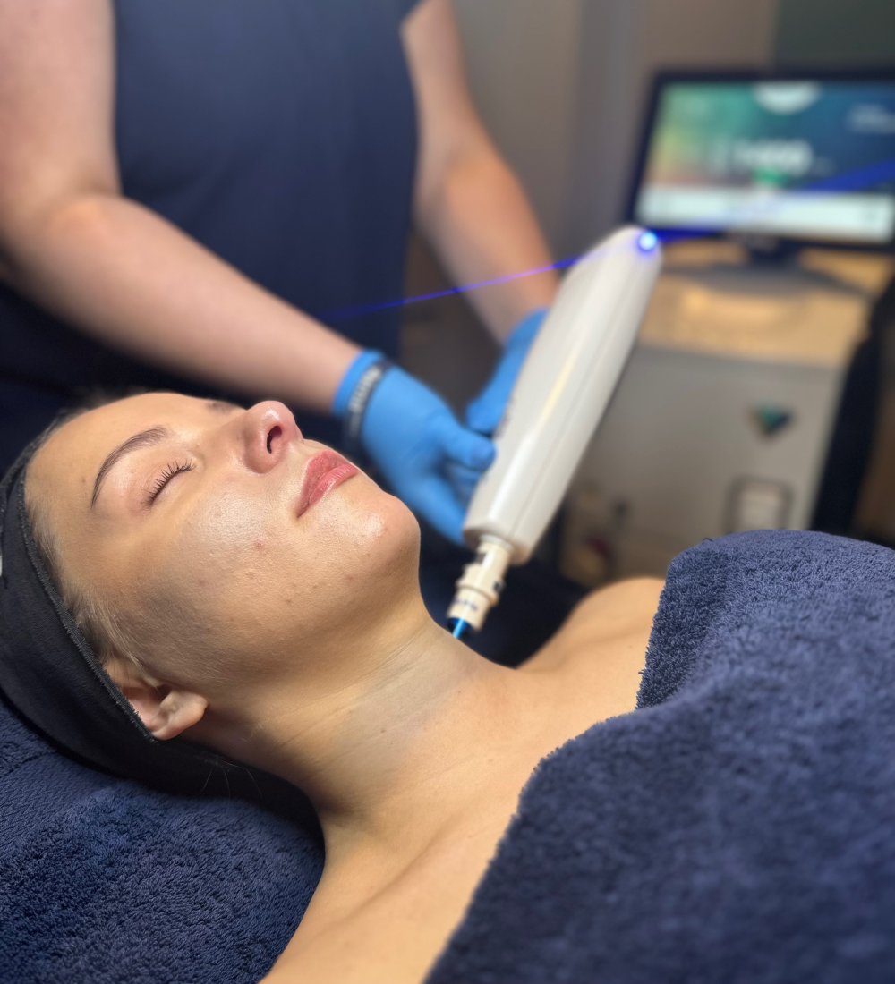 Harmony XL PRO ClearLift – SKIN lounge Aesthetics Richmond Client receiving Harmony XL PRO ClearLift treatment at SKIN lounge Aesthetics Richmond, using advanced fractional laser technology to lift, tone, and revitalise the skin without downtime.