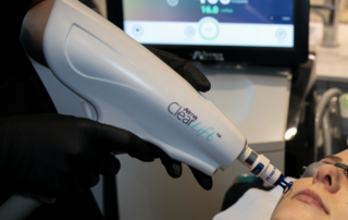 Clearlift using the Harmony XL