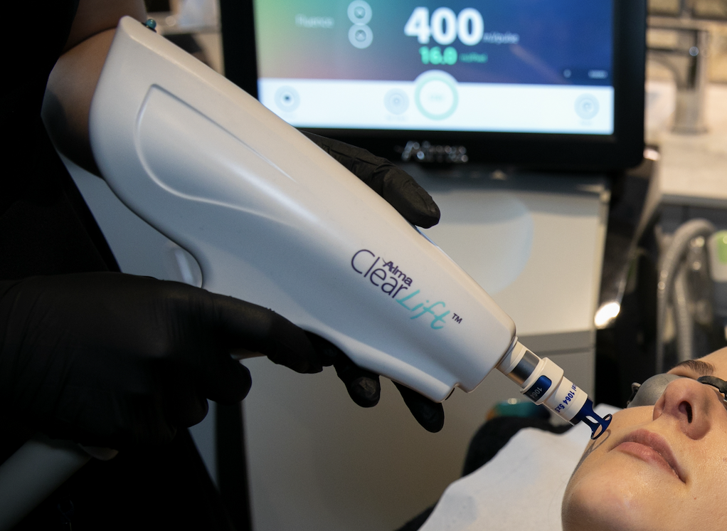 Clearlift using the Harmony XL