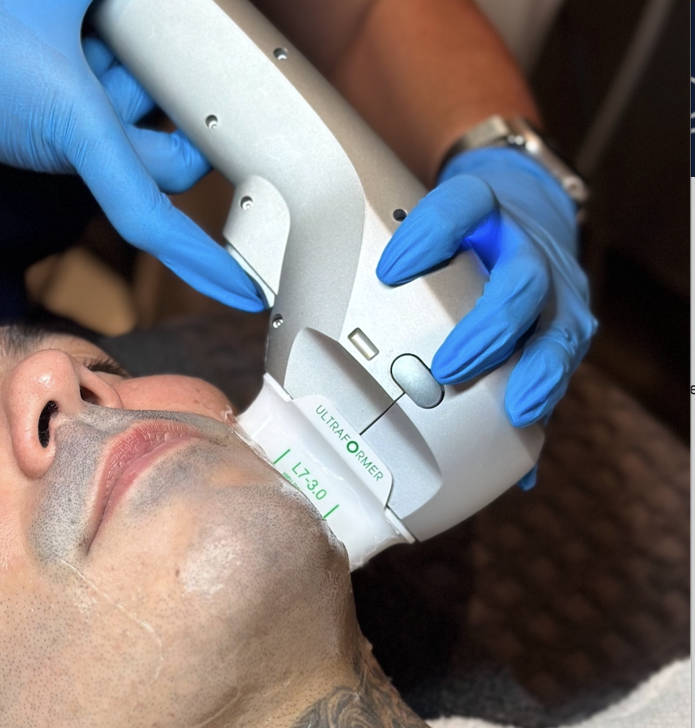 HIFU ultraformer iii