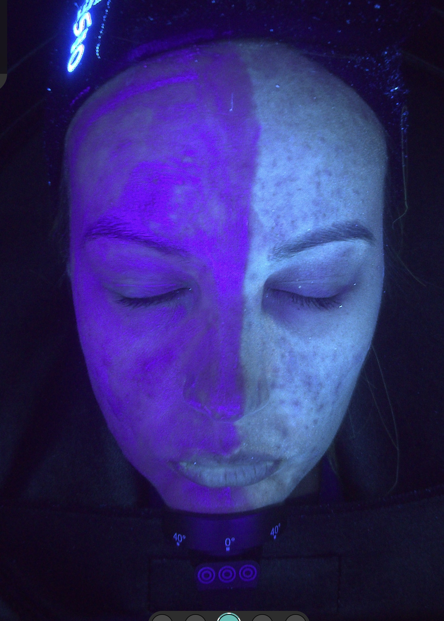 SPF block on half a face SKIN lounge Aesthetics Richmond London SPF block on half a face SKIN lounge Aesthetics Richmond London
